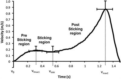 New Insights About the Sticking Region in Back Squats: An Analysis of Kinematics, Kinetics, and Myoelectric Activity